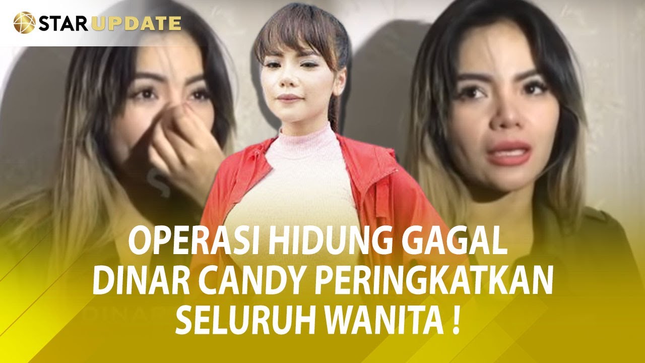 OPERASI HIDUNG GAGAL, DINAR CANDY PERINGKATKAN SELURUH WANITA !- Star Update - 20/06