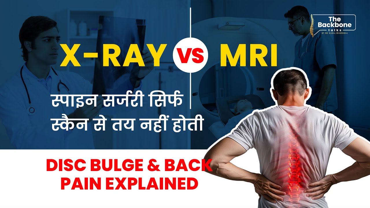 X-Ray vs MRI: Why Scans Don’t Decide Spine Surgery | Disc Bulge & Back Pain Explained