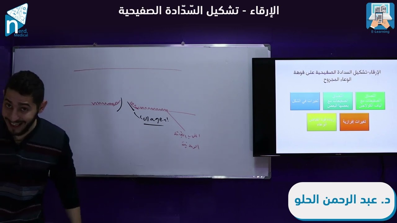 الفيزيولوجيا الطبية ـ الفصل الثالث (9) الإرقاء تشكيل السّدّادة الصفيحية