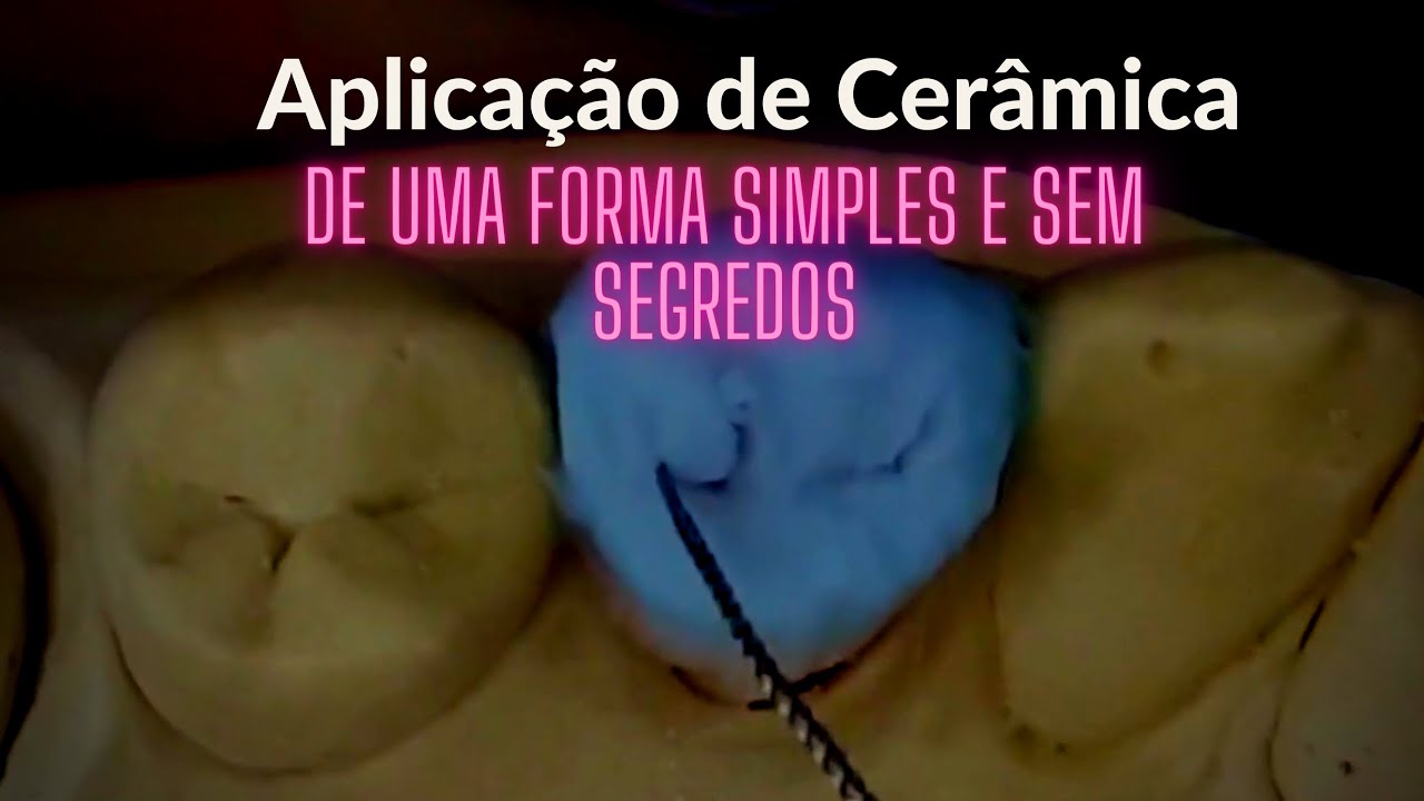 Como fazer uma aplicação de cerâmica de uma forma fácil?