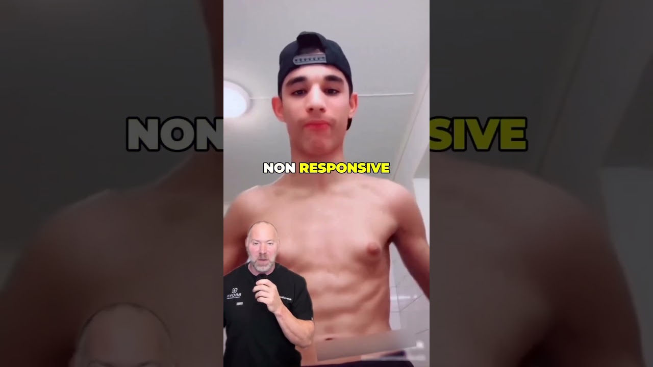 Gynecomastia Isn&rsquo;t About Weight ❌ #shorts