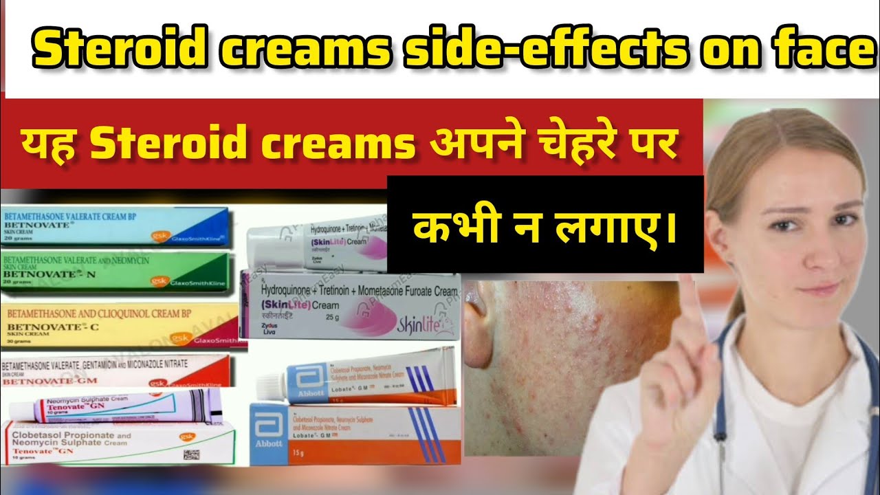 steroid creams side effects on face 