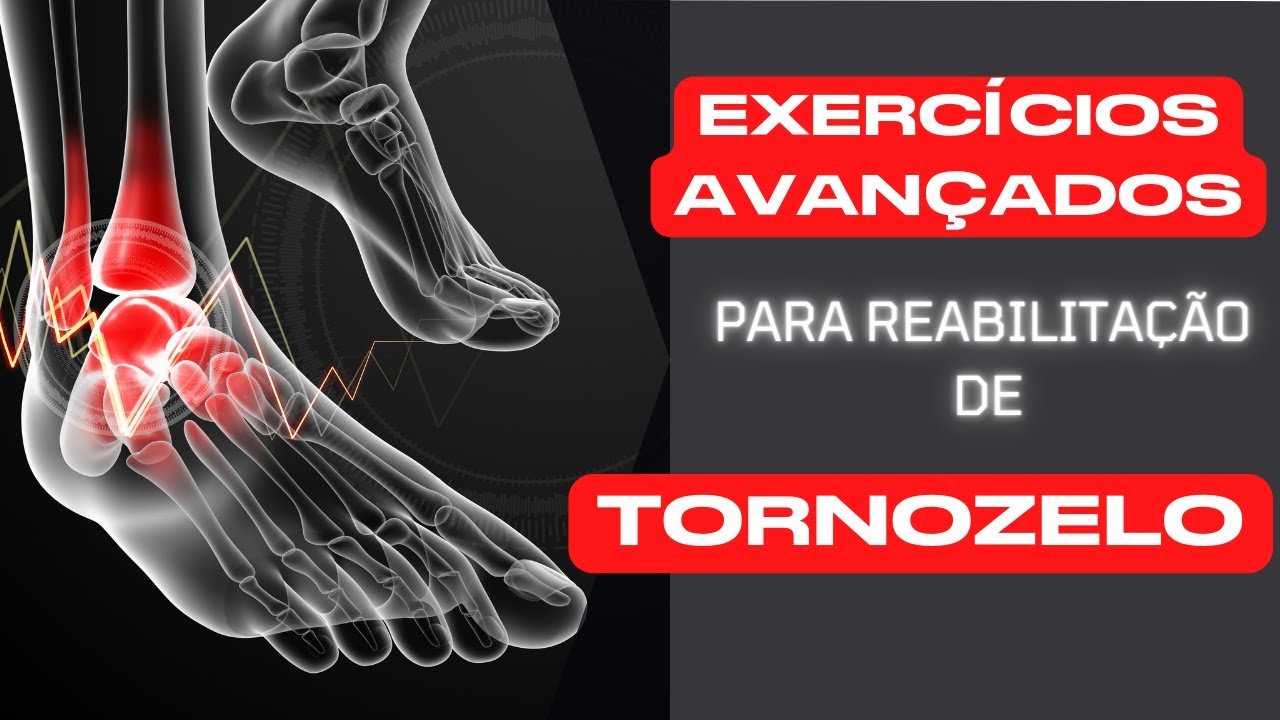 Exercícios avançados para reabilitação de tornozelo - ENTORSE, FRATURA, FISIOTERAPIA