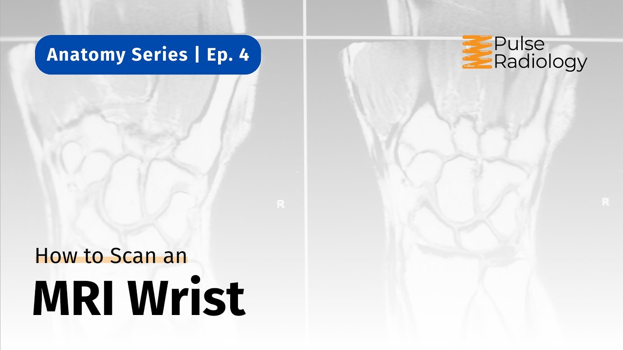 How to Scan an MRI Wrist