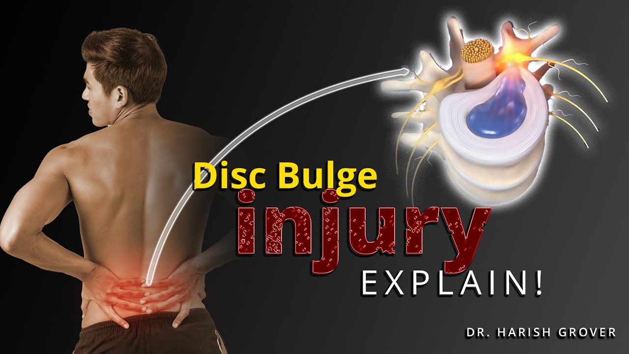 Disc Bulge Injury Explained by Dr. Harish Grover | Causes, Symptoms & Treatment