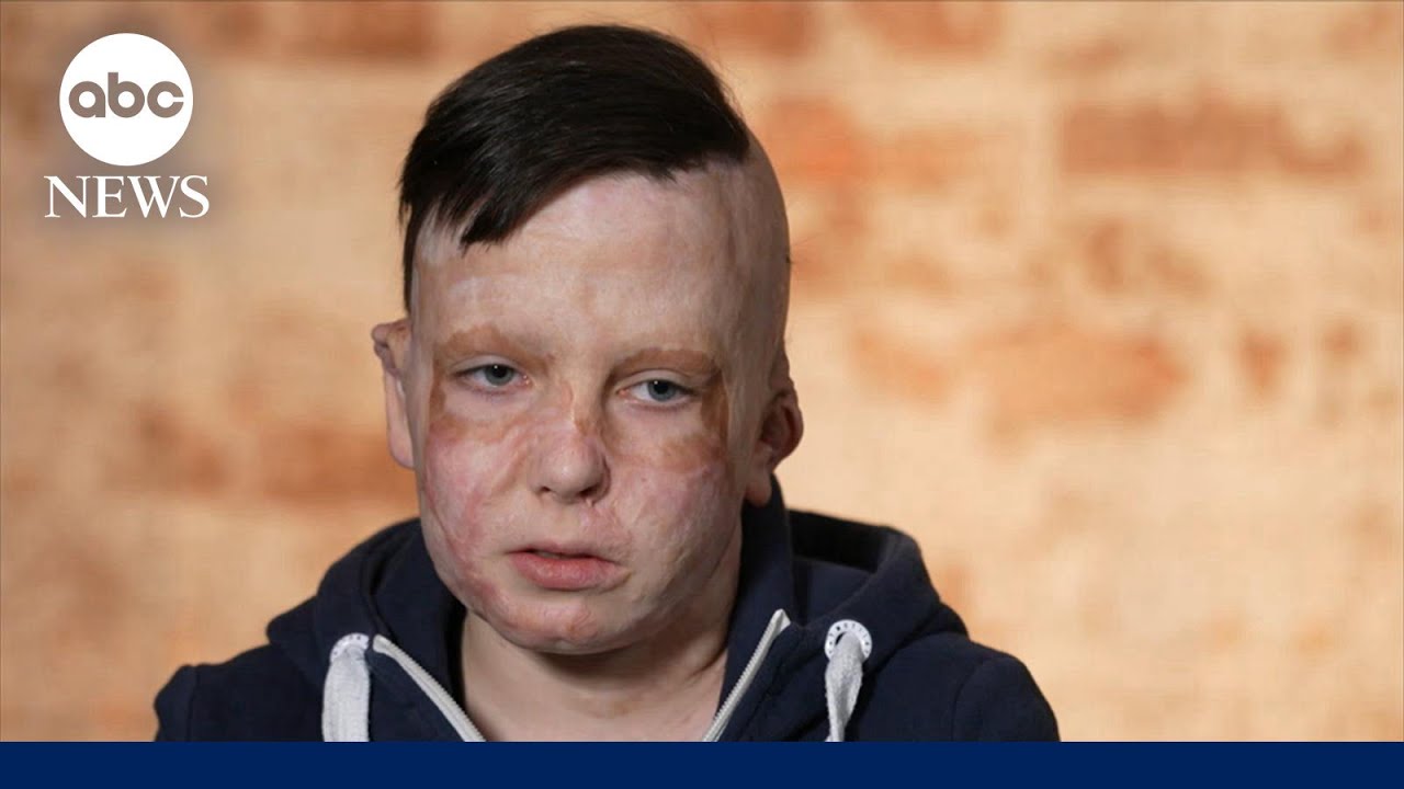 One child’s resilience after four years of war in Ukraine