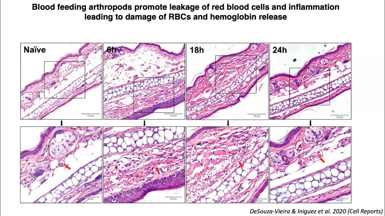 Role of the Heme Oxygenase 1 In Modulating Inflammation After Insect Bites | Azure Biosystems