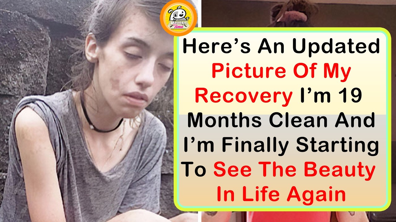 Wholesome Before and After Photos That Warm the Heart (Part 2)