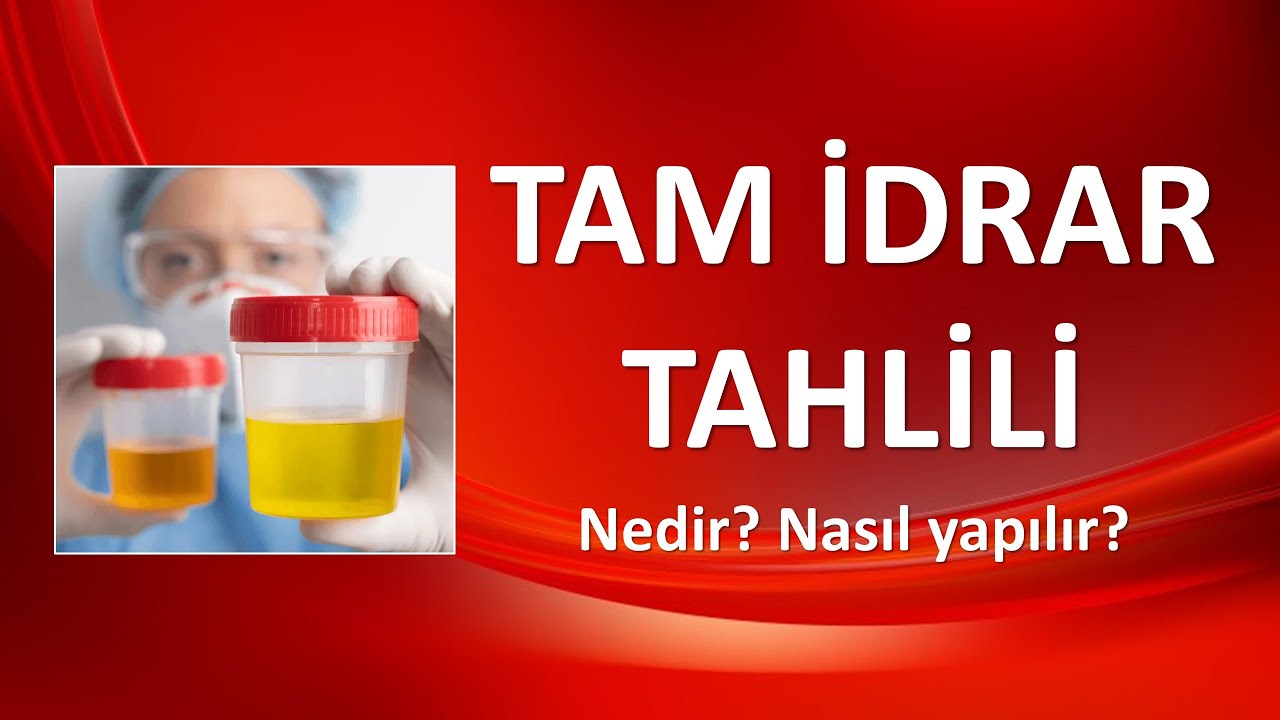 TAM İDRAR TAHLİLİ NEDİR  NASIL YAPILIR?