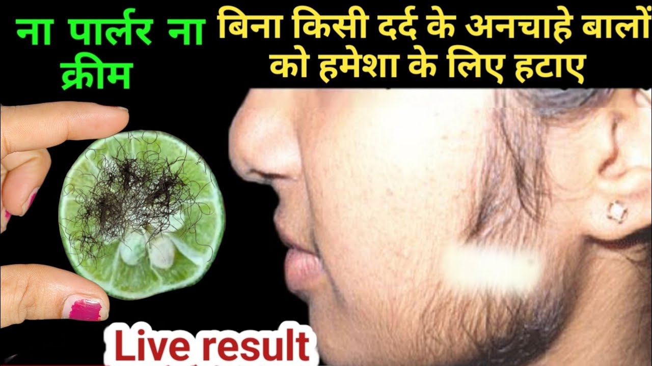 बस एक बार यह चीज मिलाकर लगा लो जिंदगी भर बाल नहीं उगेगा 😱100% working || Hair Removal at home
