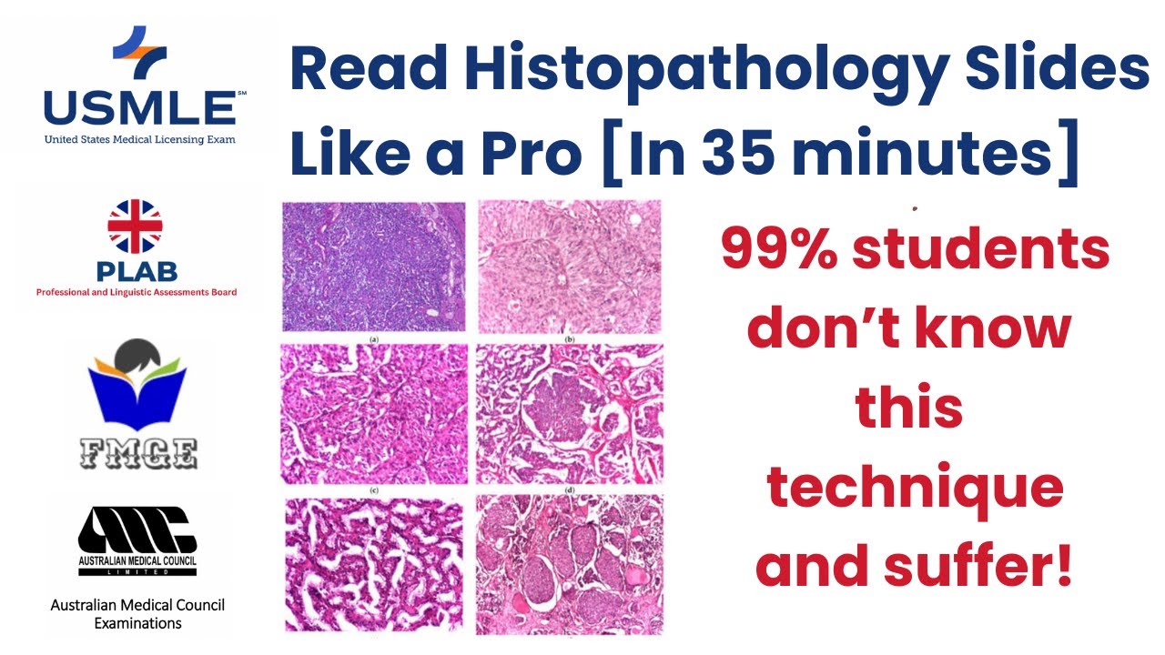 How To Read Histology/Pathology Slides? For MBBS, USMLE, PLAB, FMGE, NEET, AMC, NBME