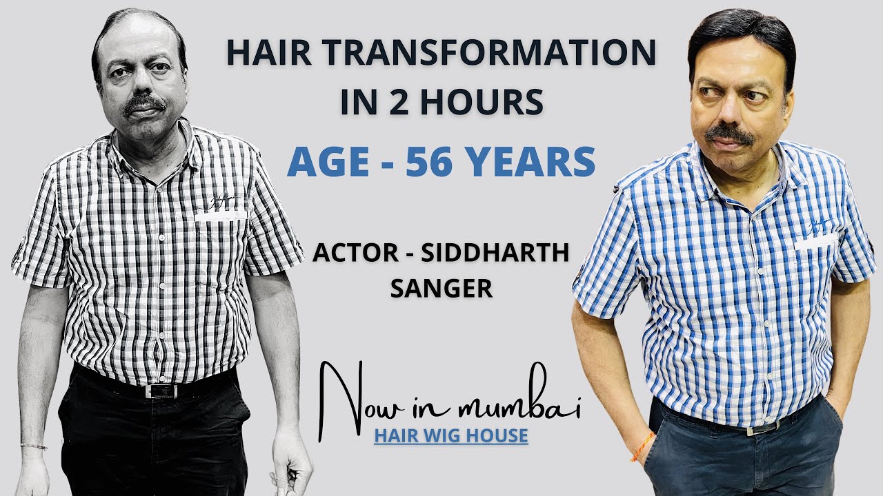 Side Parting Formal Look Hair Patch | Actor Siddharth Sanger | Hair Patch in Mumbai | Hair Wig House