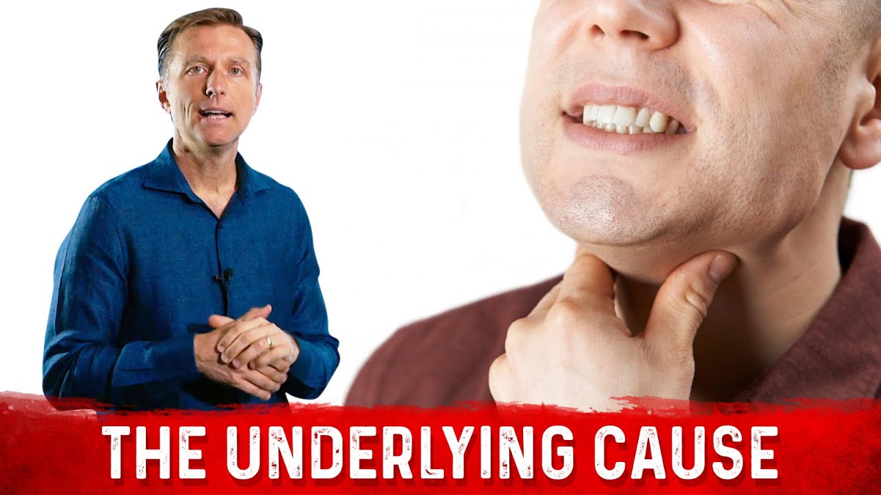 Burning Throat Syndrome or Silent Acid Reflux Causes &ndash; Dr.Berg
