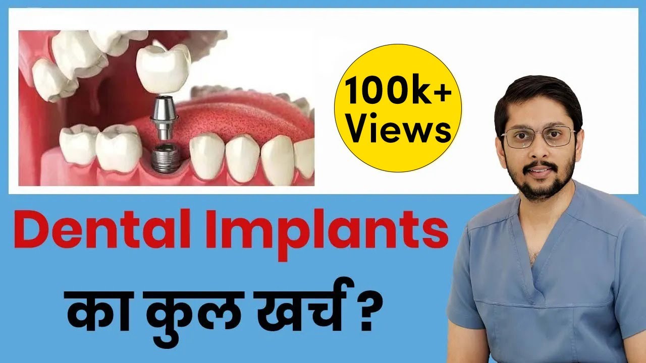 What is the cost of DENTAL IMPLANTS ?