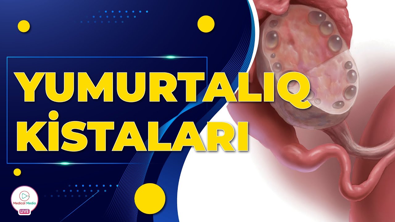 YUMURTALIQ KİSTALARI / QADINLARDA AYBAŞI ZAMANI QANAXMALAR / KİSTALARIN MÜALİCƏSİ / GİNEKOLOQ