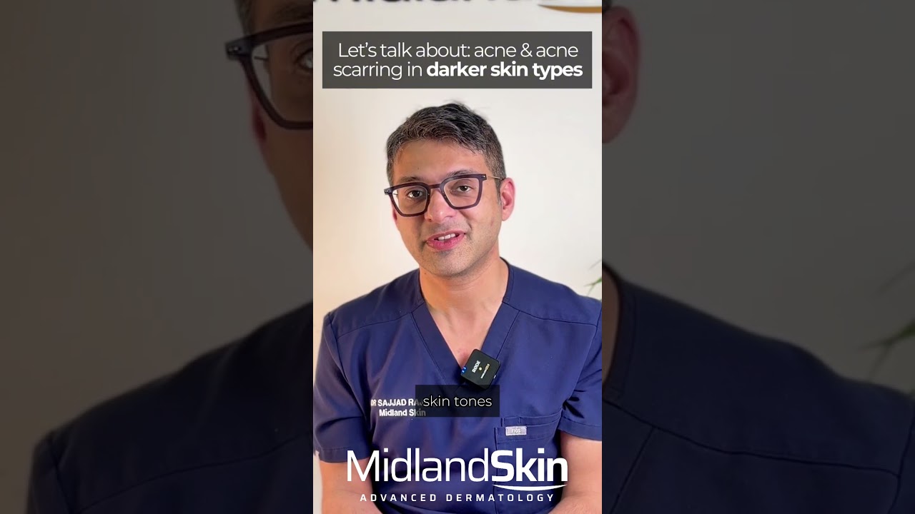 Acne in Darker Skin Types | Scarring, Hyperpigmentation & Treatment &bull; #acnetreatment #acnescarring
