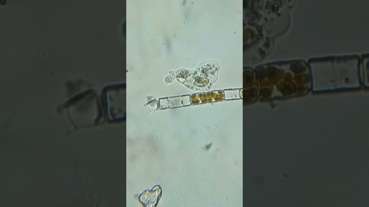 БЕСФОРМЕННАЯ красавица - АМЁБА, состоит всего из одной клетки, которая не имеет постоянной формы.