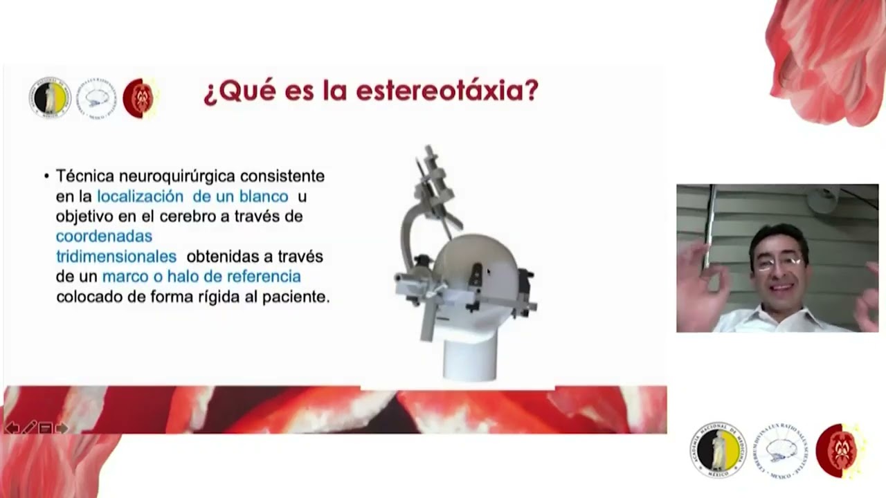 13. Estimulación Cerebral profunda: ¿cómo saber si soy candidato... Dr. Alfonso Arellano Reynoso