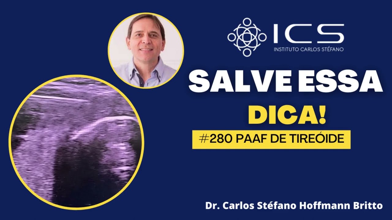 PAAF de tire&oacute;ide guiada por ultrassom