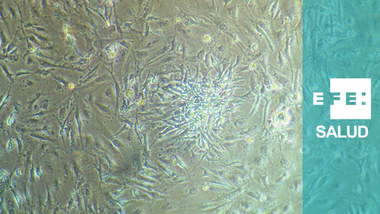 Células pluripotenciales inducidas, regeneración futura de tejidos corporales