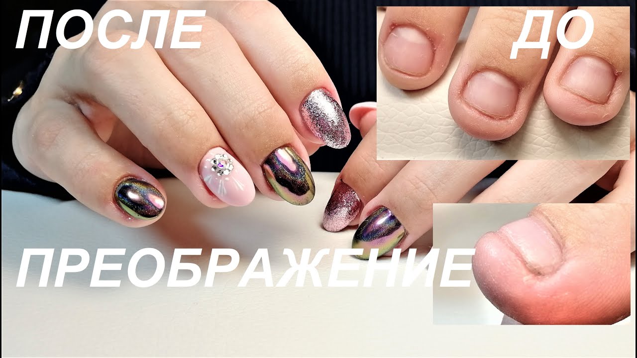 Маникюр на ногти грызуна. Преображение обкусанных ногтей