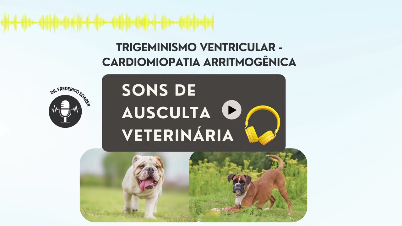 Trigeminismo ventricular - cardiomiopatia arritmogênica | EP. 21