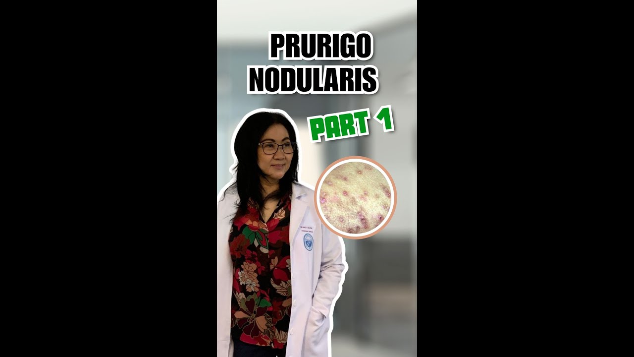 PART 1 Prurigo Nodularis