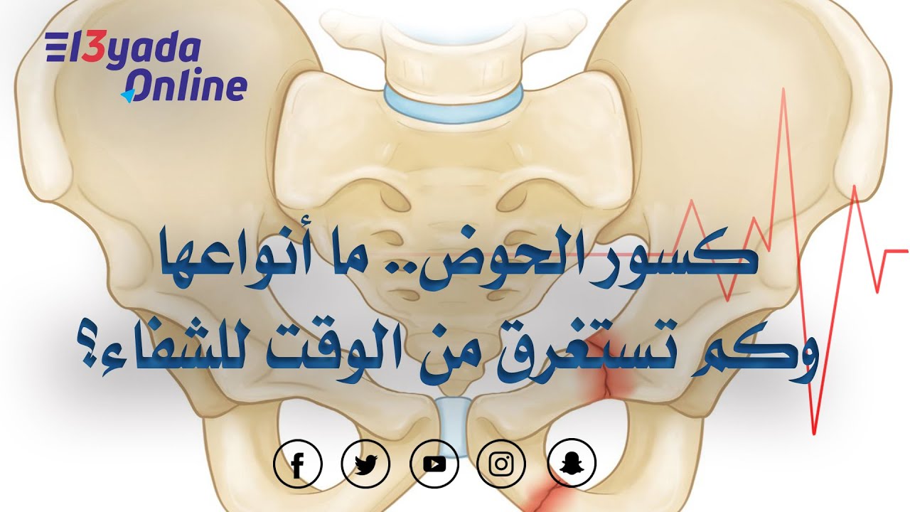 كسور الحوض .. أنواعها وطرق علاجها//Pelvic fractures .. types and methods of treatment