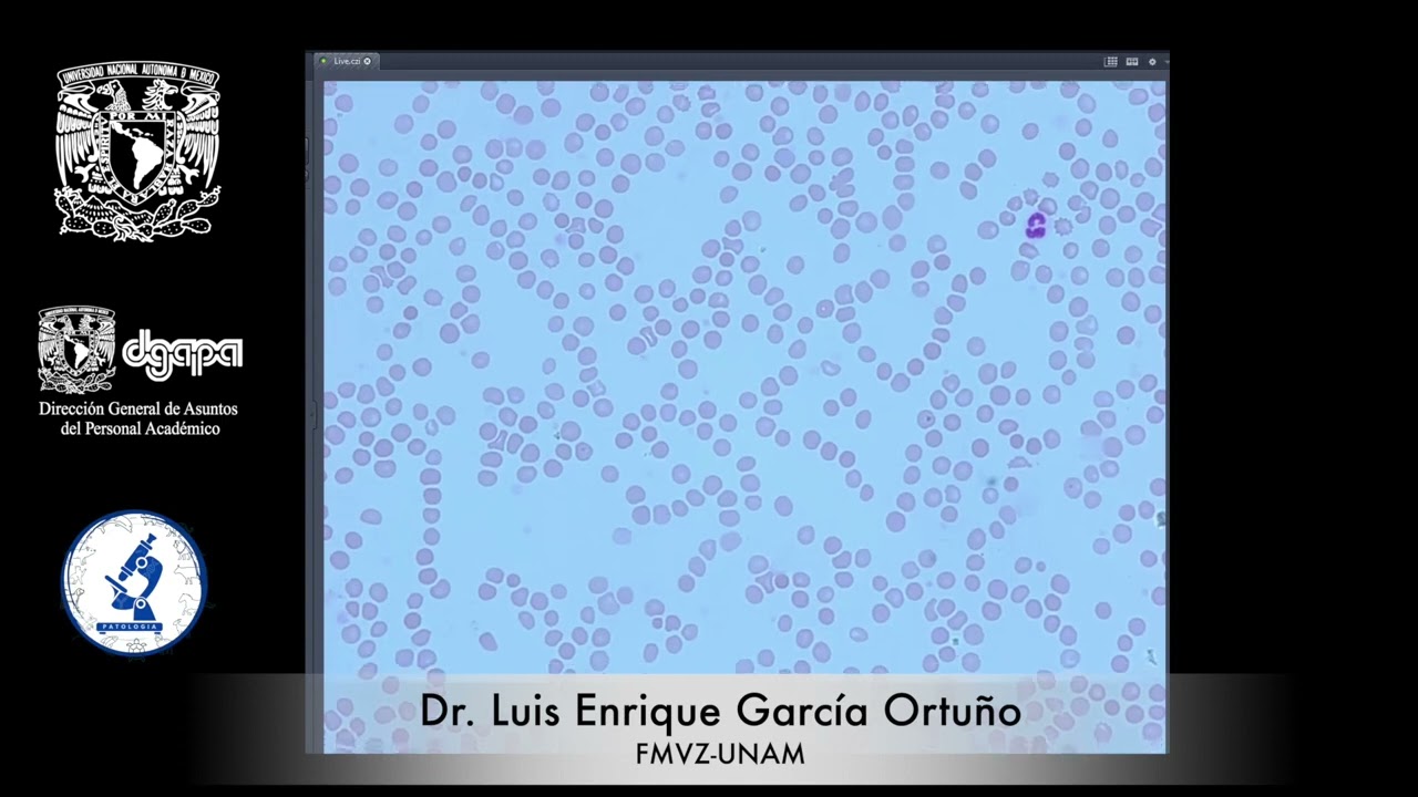 PRACTICA 10. DIFERENCIAL DE LEUCOCITOS.