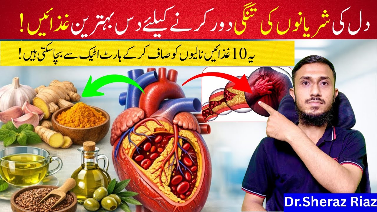 Blocked Arteries? Eat These 10 Foods to Unclog Heart Arteries Naturaly