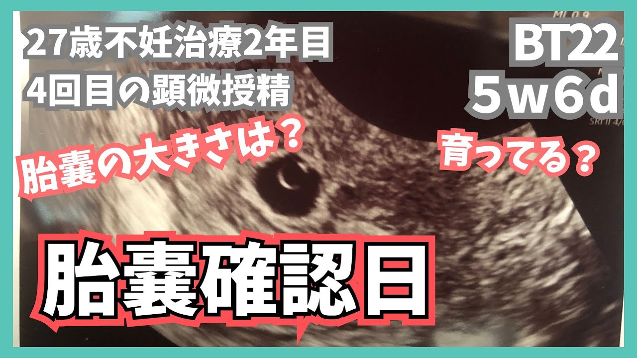 【妊活】異所性妊娠か！？そうでないか！？着床した場所はいかに…5w6dドキドキの胎嚢確認#不妊治療vlog #不妊治療 #体外受精