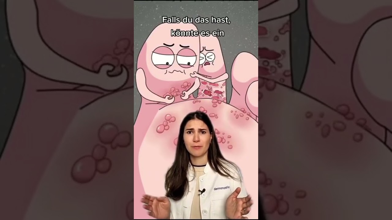 Juckende Bl&auml;schen an den F&uuml;&szlig;en? 😖│Dr. med. Alice Martin #shorts