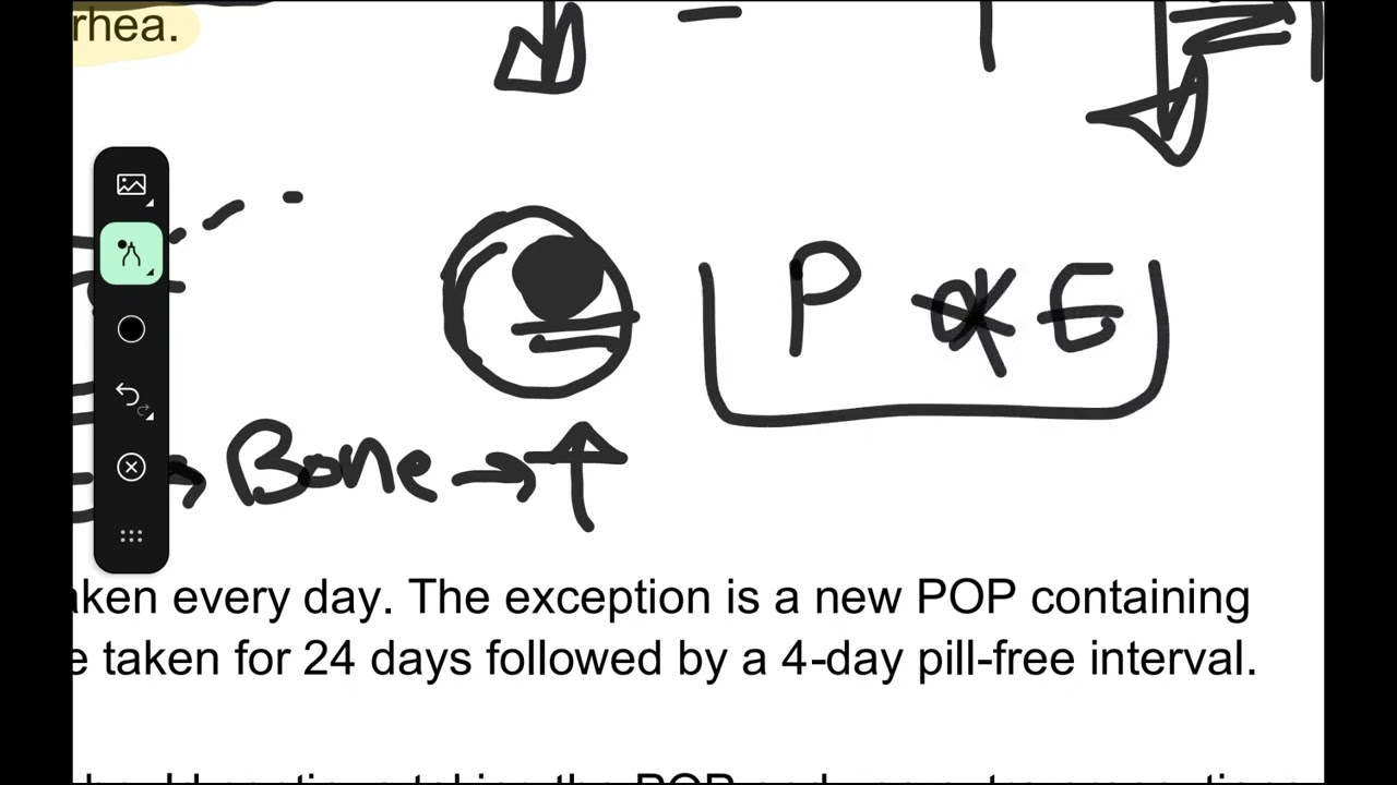 Contraception 3 (progestogen-only contraceptive)
