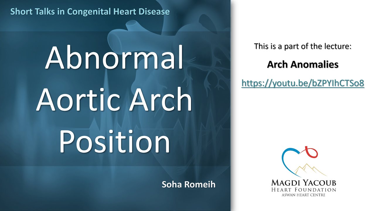 Abnormal Aortic Arch Position - Soha Romeih
