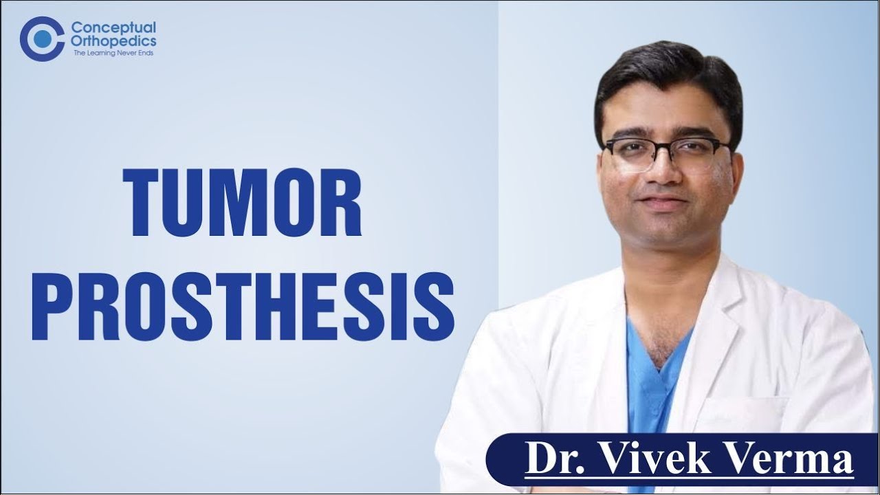 Tumor Prosthesis By Dr. Vivek Verma