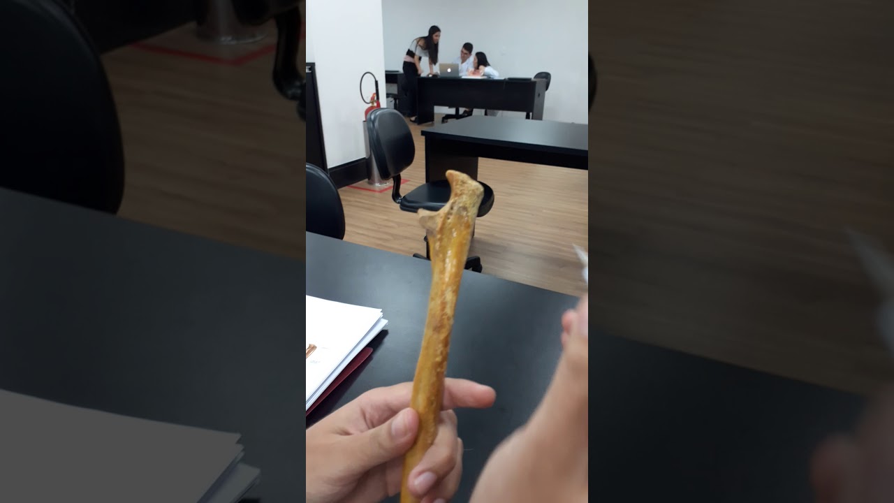 Osso Ulna - acidentes anatômicos