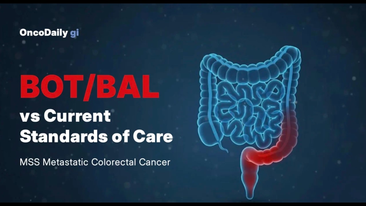 Botensilimab and Balstilimab New Immunotherapy Strategy for MSS Colorectal Cancer