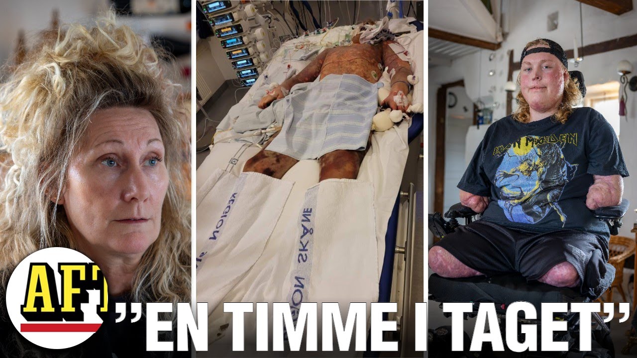 Viktor, 18,  vaknade upp utan armar och ben: 
