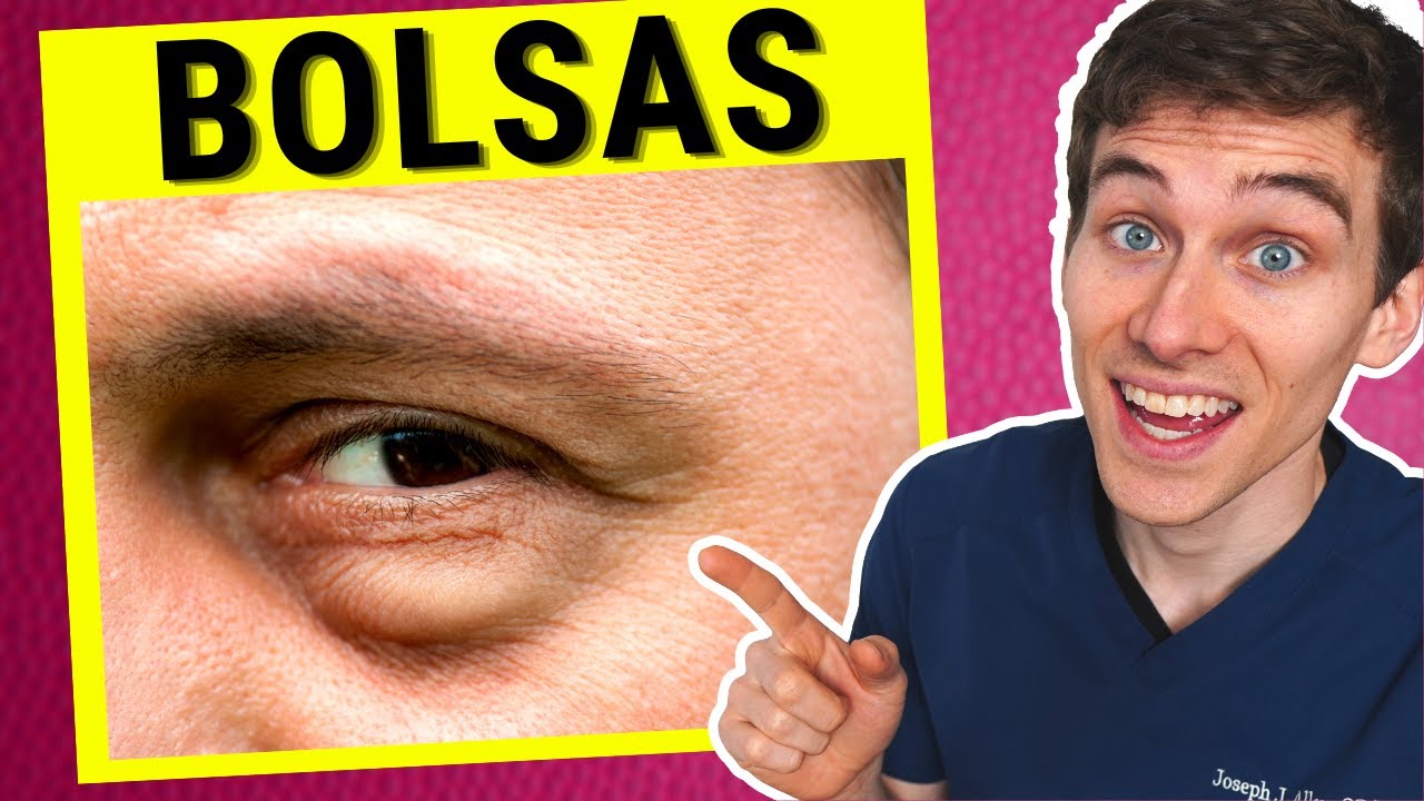 Optometrista Explica Cómo Deshacerse de las Bolsas en los Ojos