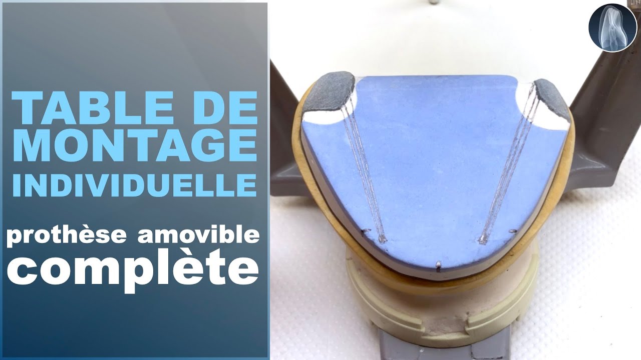 Comment Tracer les Repères de Montage pour une Prothèse Complète : Guide Pas à Pas !