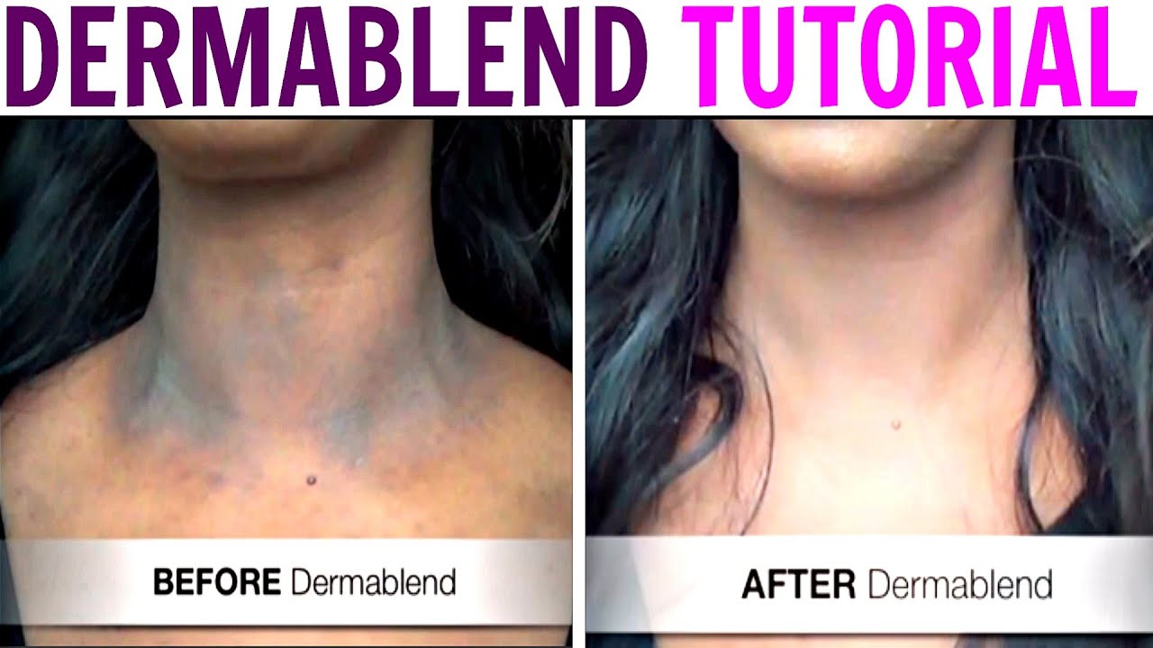 Cover Scars, Tattoos, Dark Spots with DERMABLEND  - Best Body Makeup Ever!
