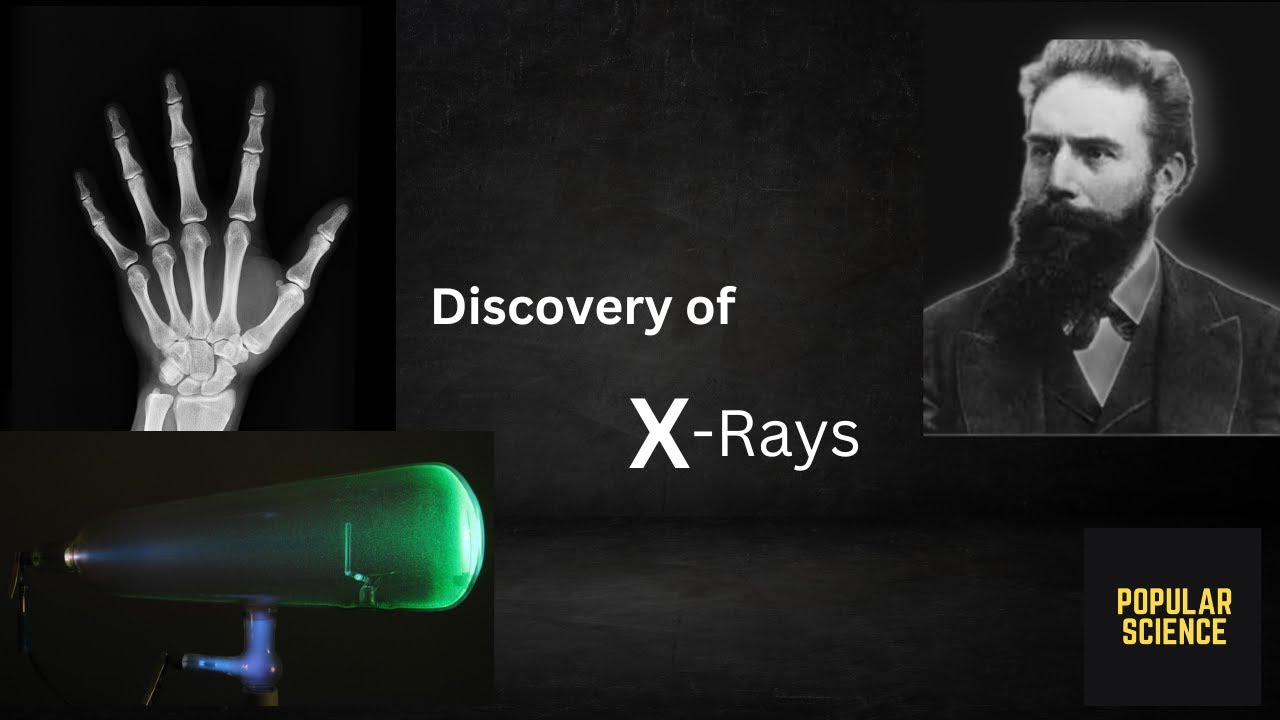 History of X-ray | From discovery to modern day technology