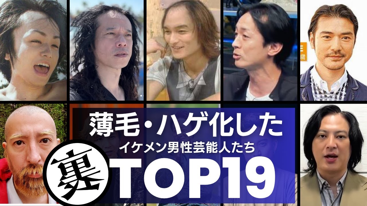 青春時代のイケメンたちが…。『薄毛・ハゲ』を指摘されている男性芸能人TOP19