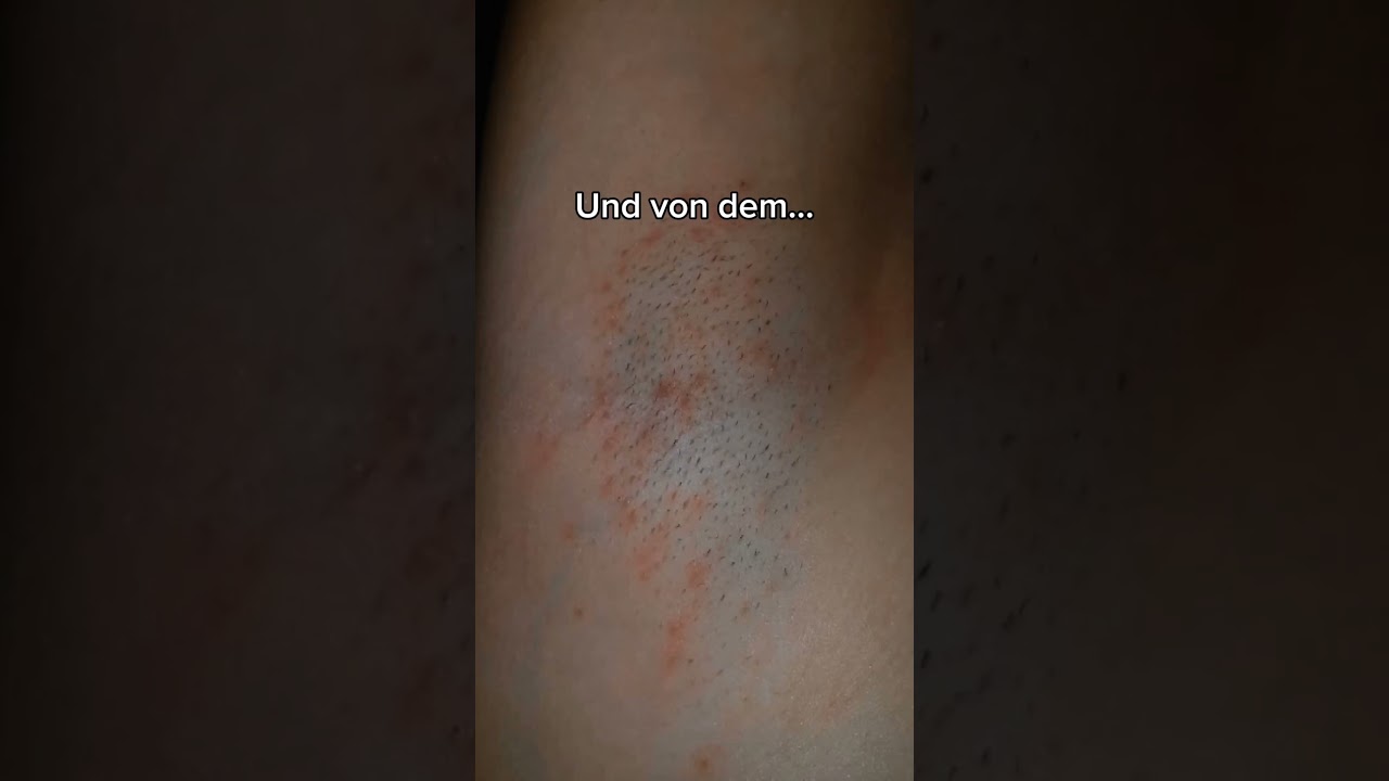 Nur Frauen wissen, wof&uuml;r und wie wichtig das ist...😘 #rasieren #rasierpickel #laserhaarentfernung