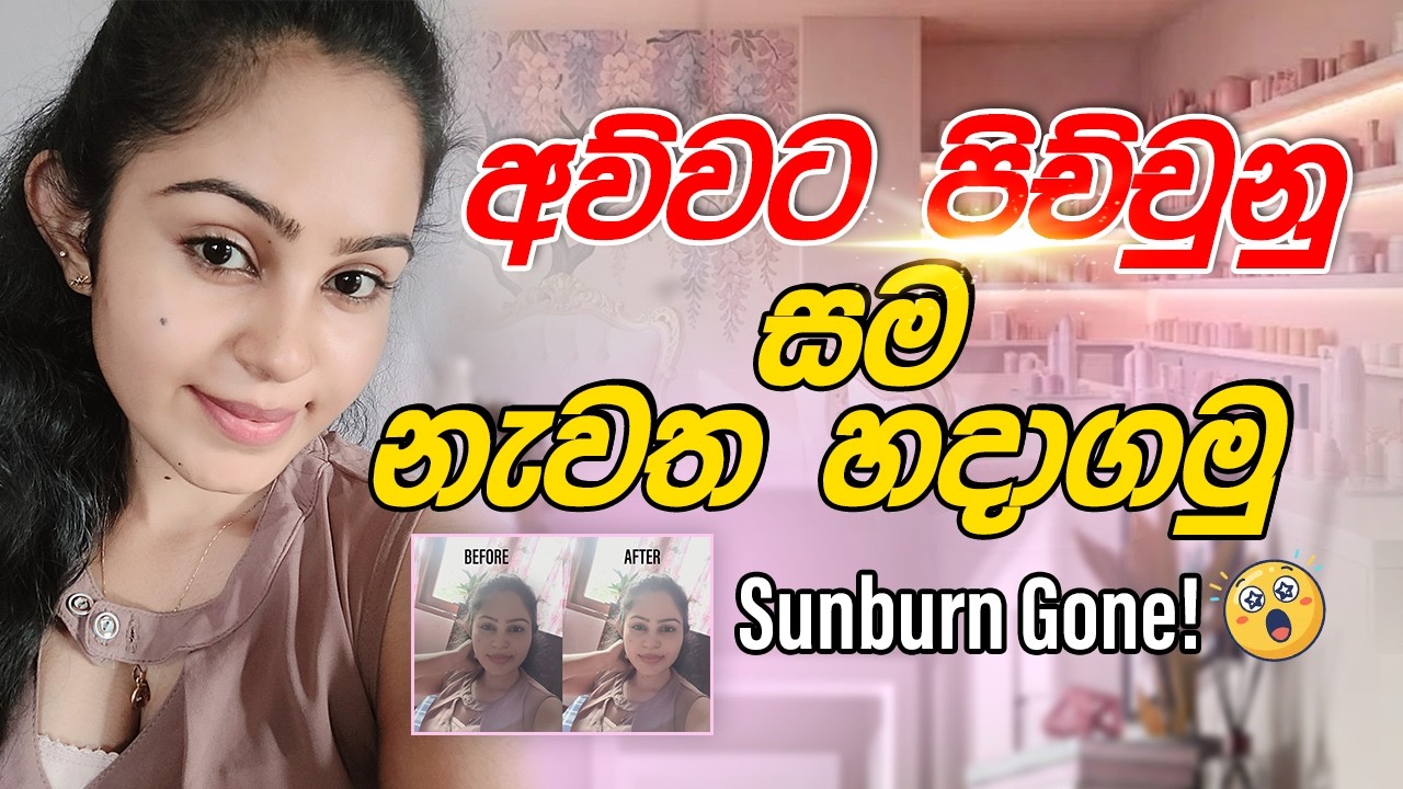 අව්වට පිච්චුන සම නැවත හදාගමු  - skincare routine #skincare #dayvlog