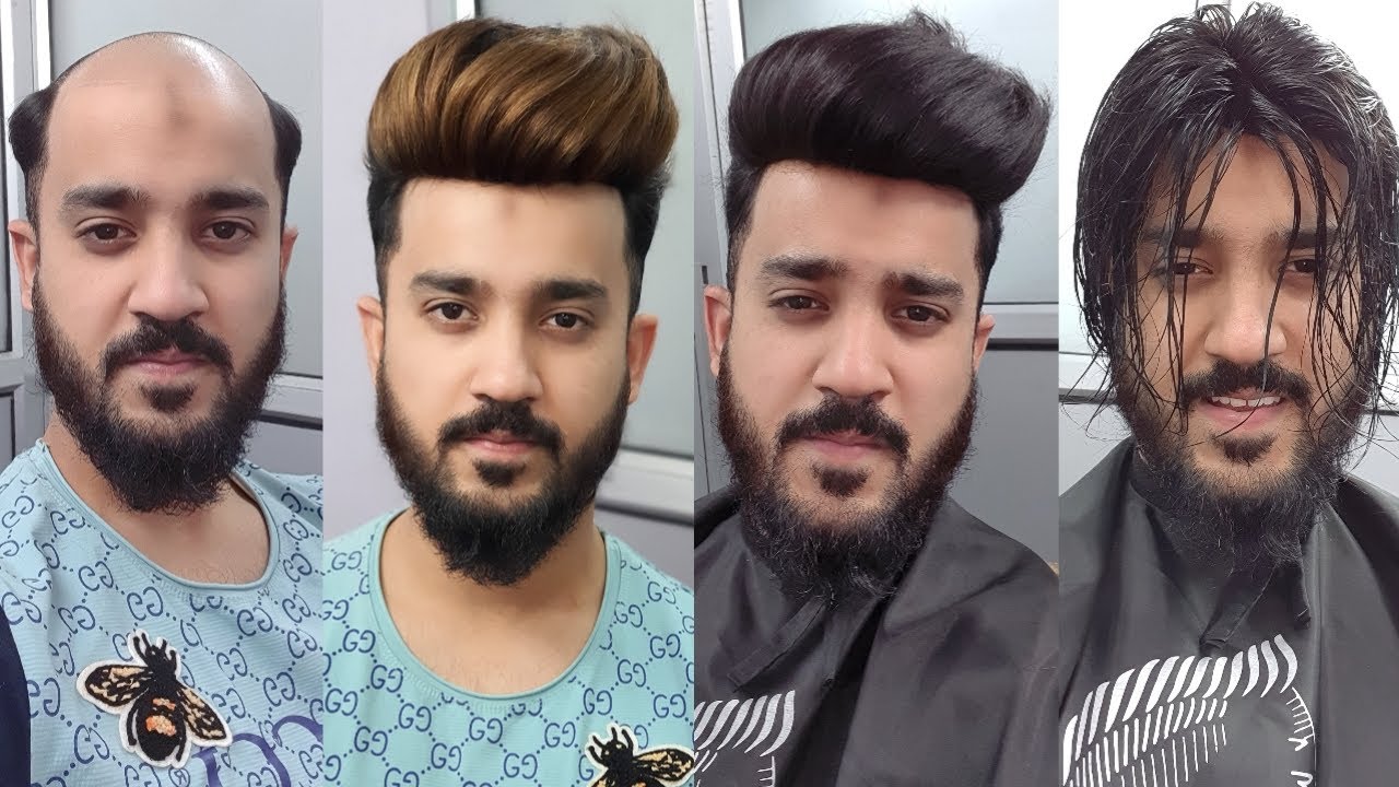 Heavy puffy stylish hair patch system in delhi by anas sheikh call us 9650914665,