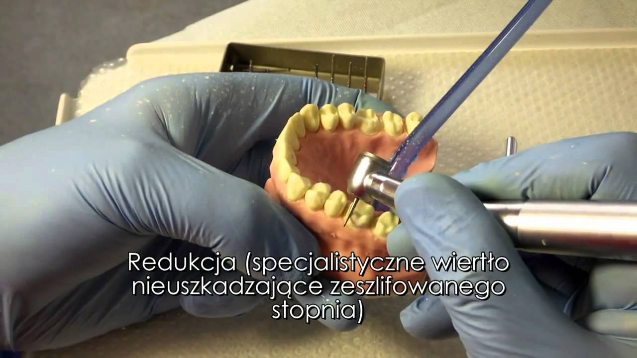 Preparacja zęba pod koronę w 10 minut systemem CCQ od Doktora Andrzeja Zavadki