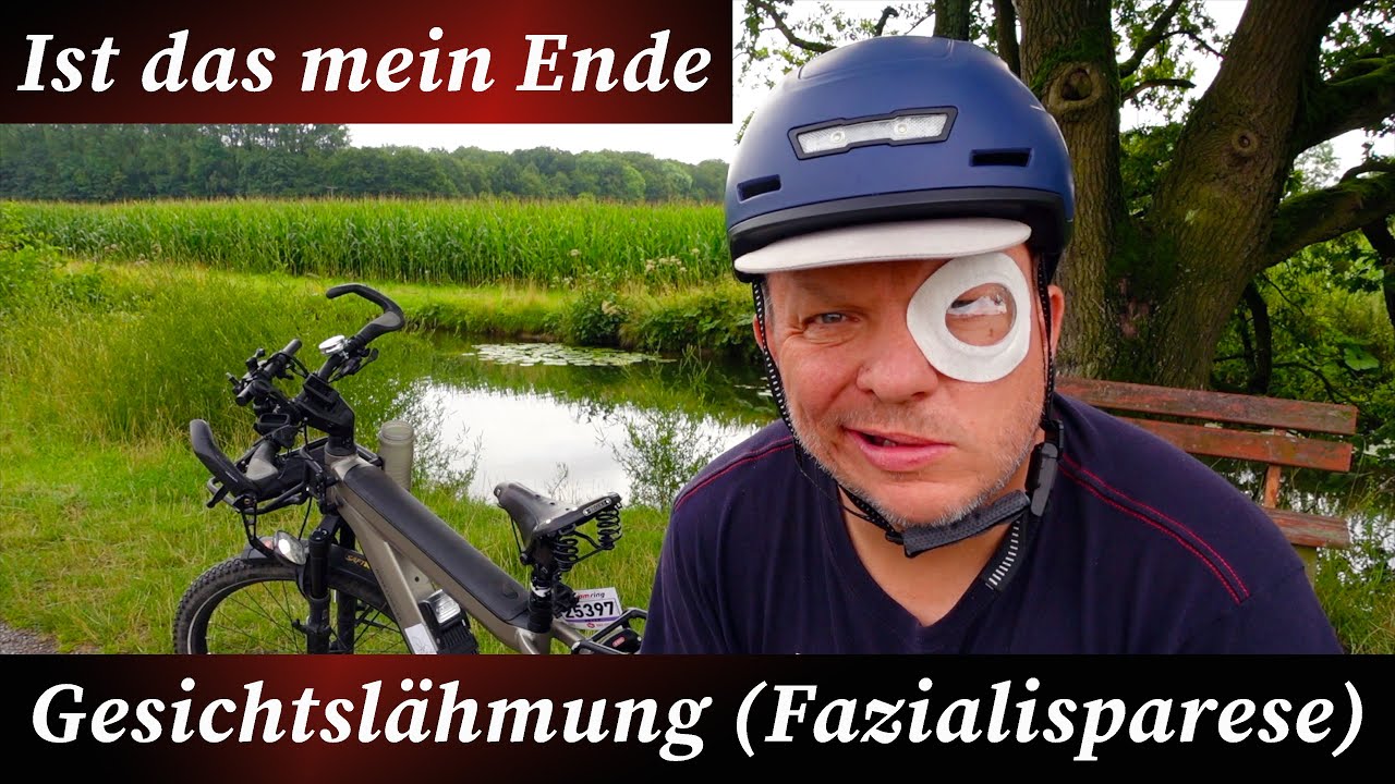 Das Ende mit E-Bike Touren durch Gesichtslähmung (Fazialisparese)?🙈