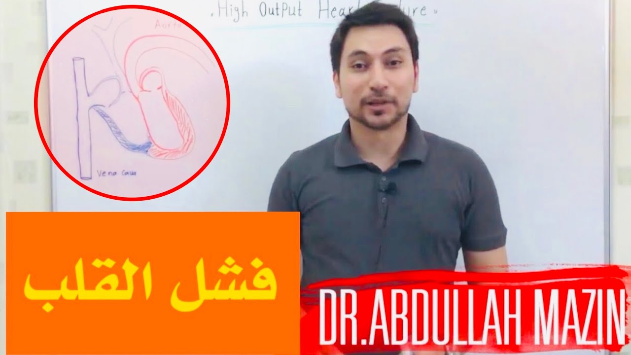 Cardiology High-output heart failure الفشل القلبي