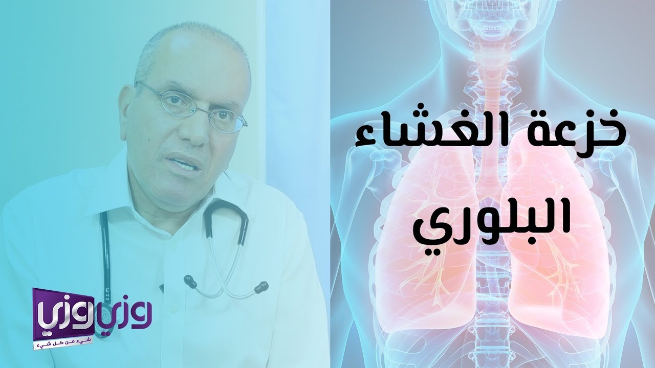 خزعة الغشاء البلوري